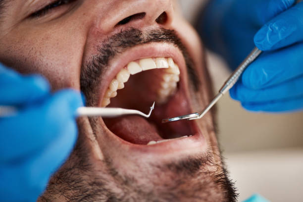 Best Emergency Treatment for Dental Infections or Abscesses in Bradfordville, FL